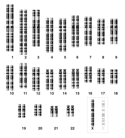 Monosom�a